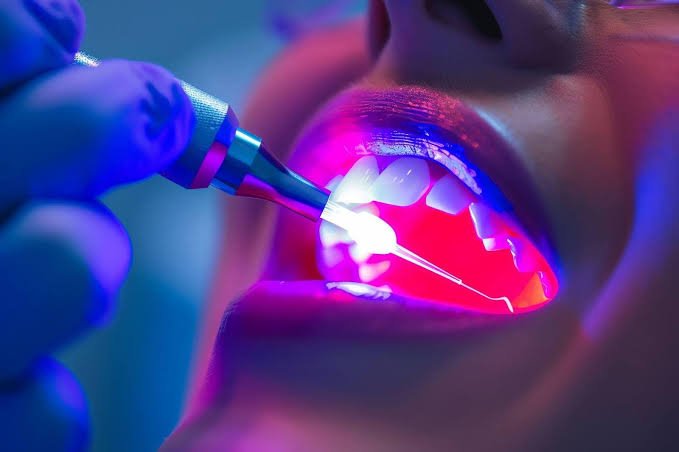 laser